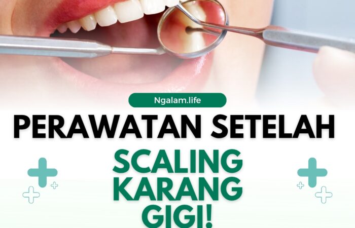 Scalling karang gigi