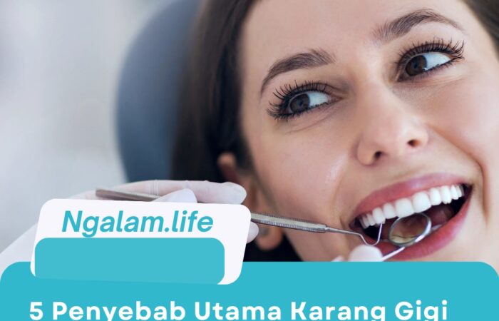 Penyebab karang gigi