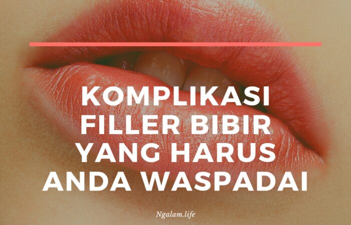 Filler bibir