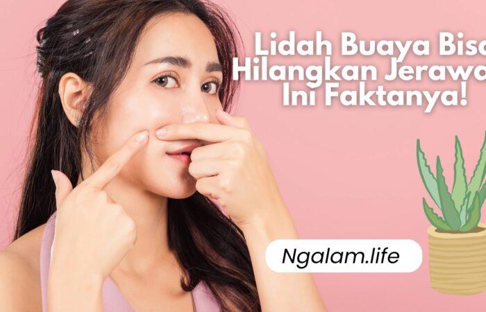 Lidah buaya untuk jerawat