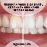 Membuat gigi putih