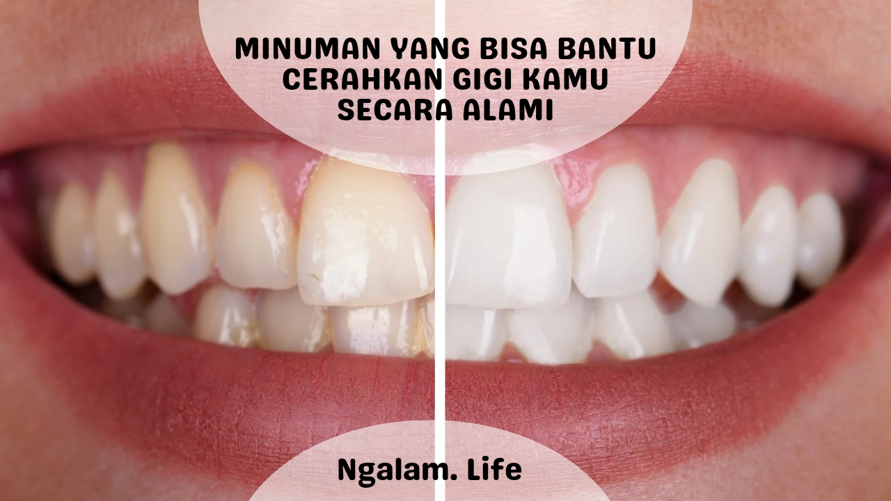 Membuat gigi putih